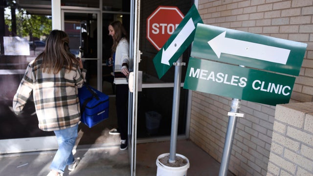 measles.jpg 