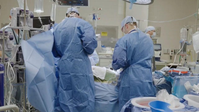 cbsn-fusion-1-in-5-organ-donations-being-tossed-out-cbs-news-analysis-finds-thumbnail5bf3