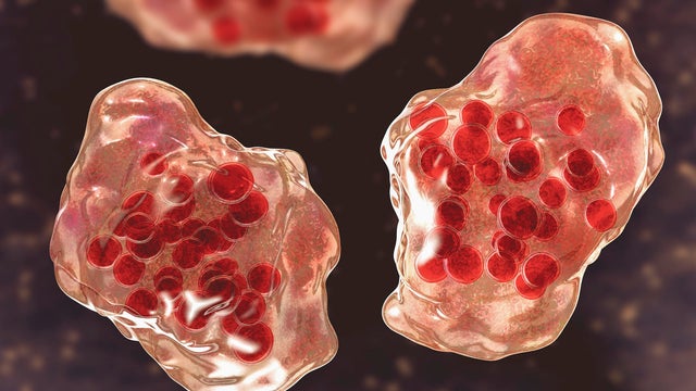 Measles virus infection, illustration 