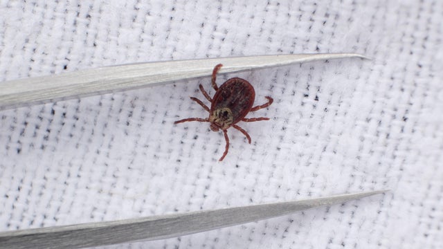 A tick and a pair of tweezers 